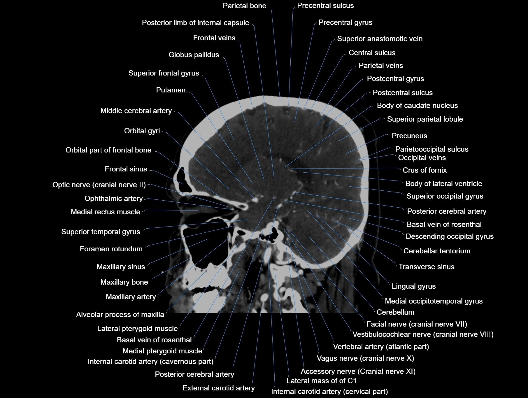 CT scan brain sagittal cross sectional anatomy image-img-00001-00030.webp